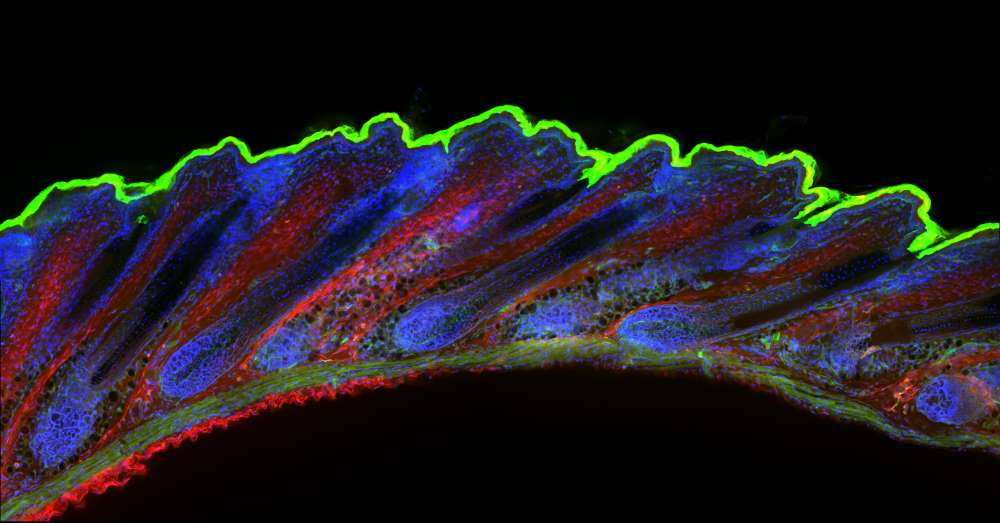 The Afican Spiny Mouse Histology
